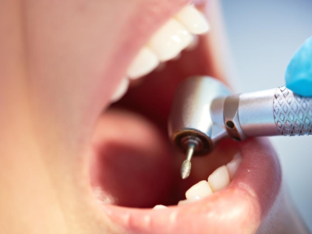 Fase 2: anche l'ortodonzia riparte in sicurezza. Pubblicate le indicazioni operative dal ministero della Salute
